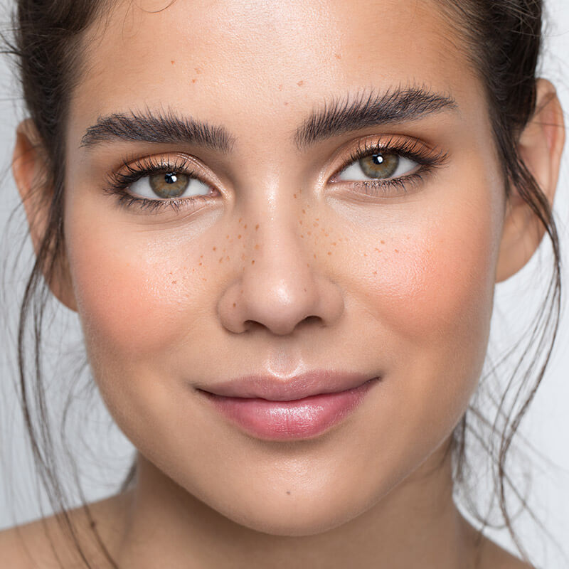 Refreshed with Restylane