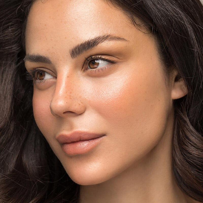 Sculptra for natural volume