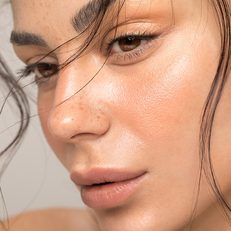 Youthful volume and skin texture with Renuva