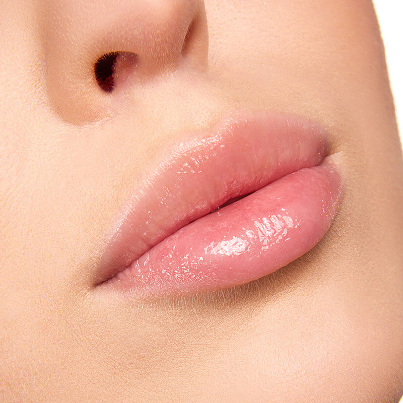 Injectable UltraXC for plumper lips