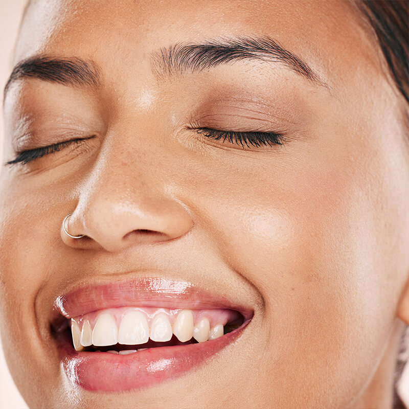 SkinPen Microneedling