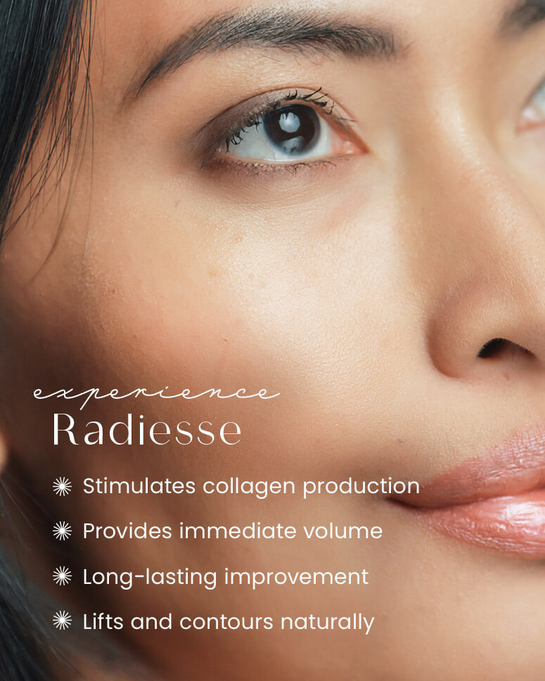 100925-radiesse-benefits
